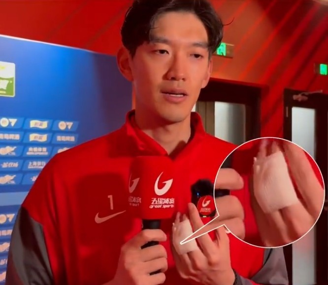 九游体育-颜骏凌：赛前热身手指脱臼，这时候更需要给球队信心所以坚持完赛